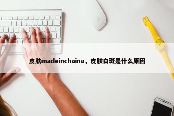 皮肤madeinchaina,皮肤白斑是什么原因 皮肤madeinchaina,皮肤白斑是什么原因